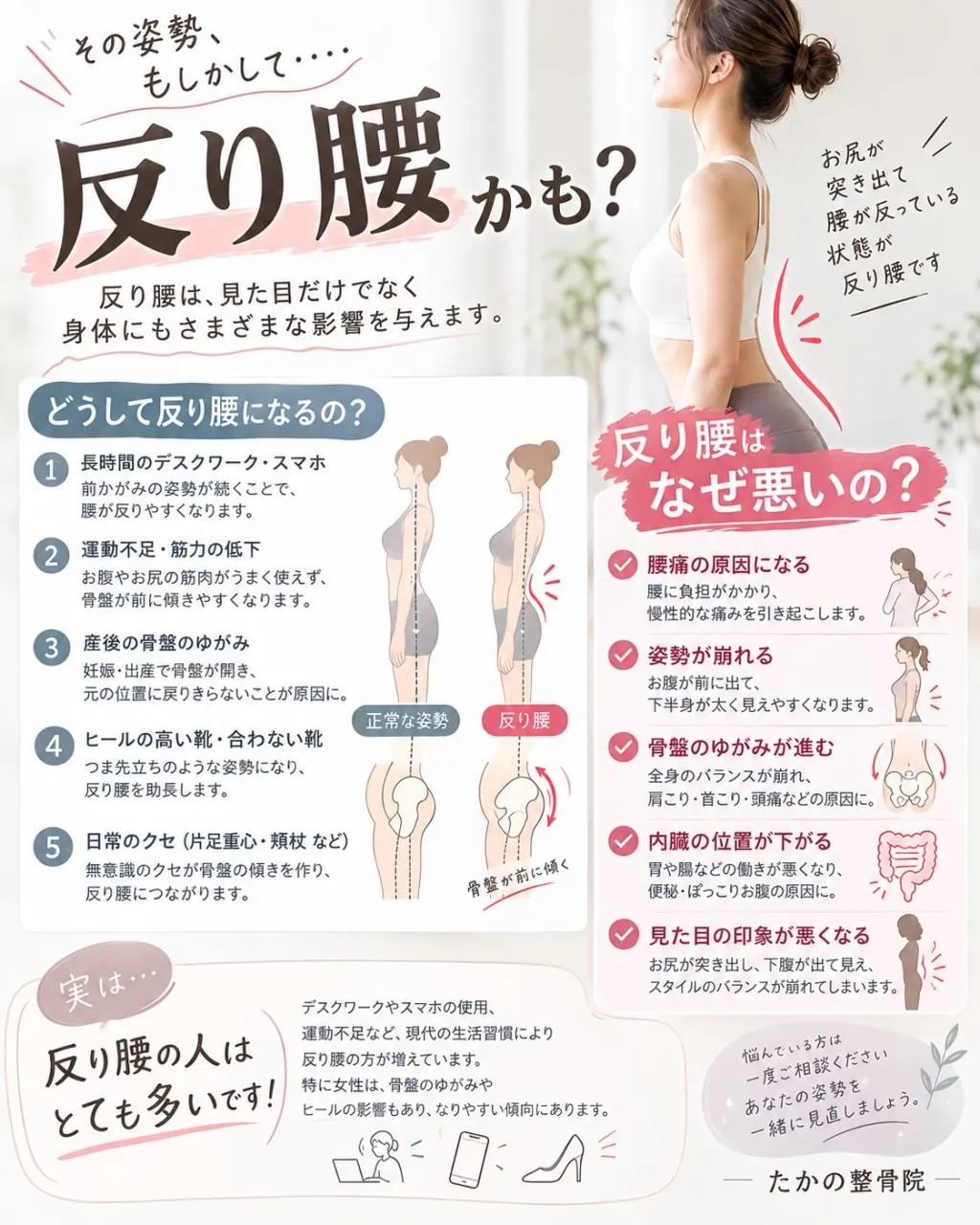 【その姿勢、反り腰かも？😳】